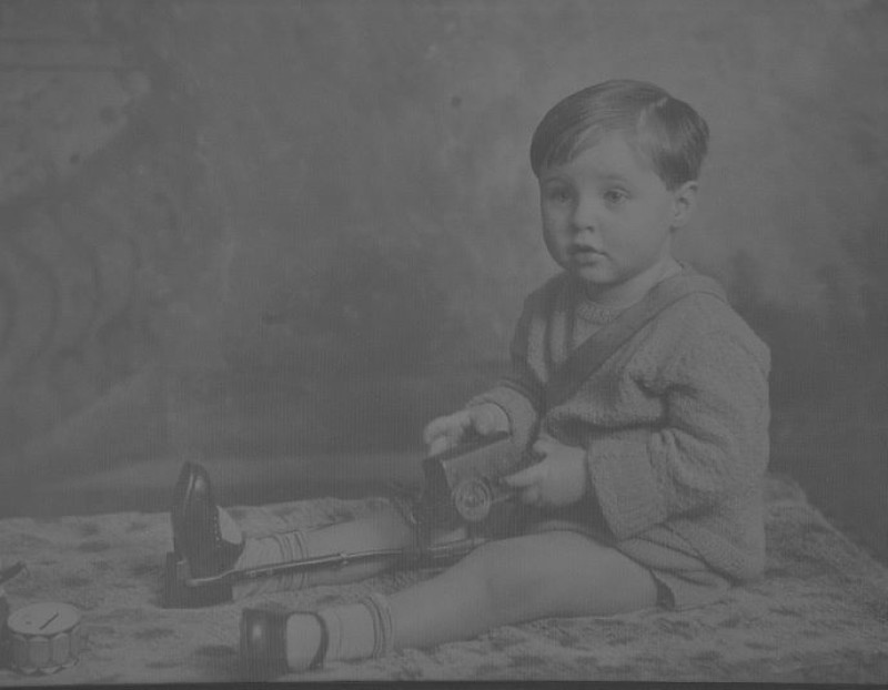 Other image for How Malcolm’s lived as a polio survivor for 80 years